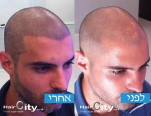 תמונות הדמיית שיער 03