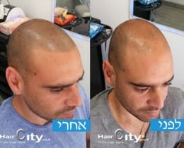 תמונות הדמיית שיער 03