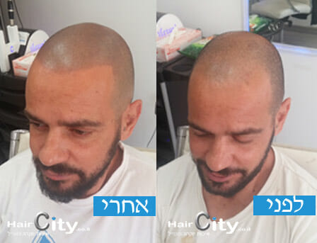 הדמיית שיער 2