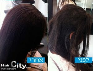 שיקום שיער בגבעתיים