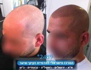 סימולציה לשיער