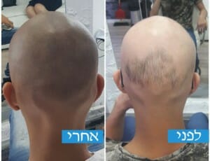 הדמיית שיער בירושלים